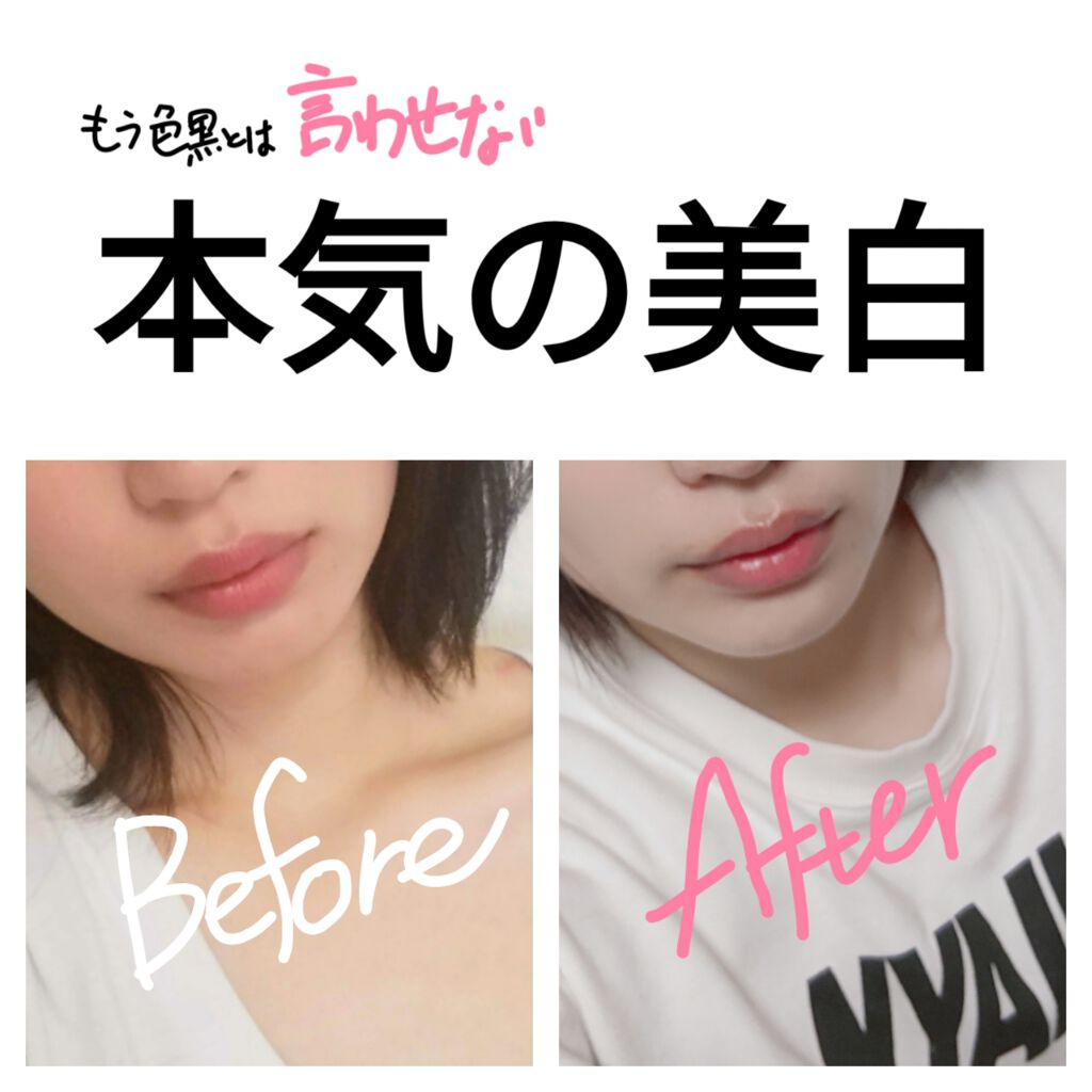 美白になる方法 L システイン Now Foodsの美白効果 使い方 色黒と言われて続けてい By あこる 乾燥肌 代後半 Lips