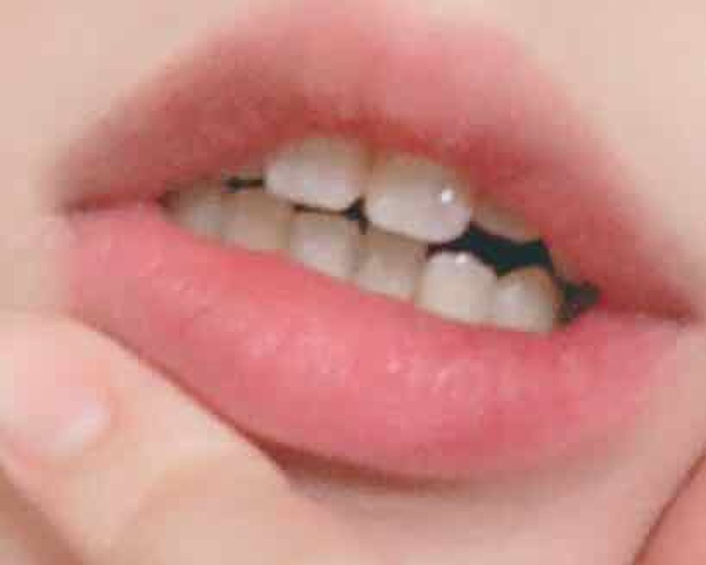 ハイドロチャージ リップバーム/Elégance/リップバームを使ったクチコミ（2枚目）