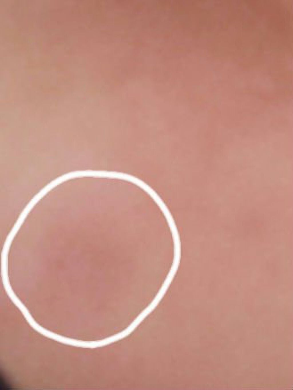 プロCICA クリアスポットパッチ/VT/その他スキンケアを使ったクチコミ(5枚目)