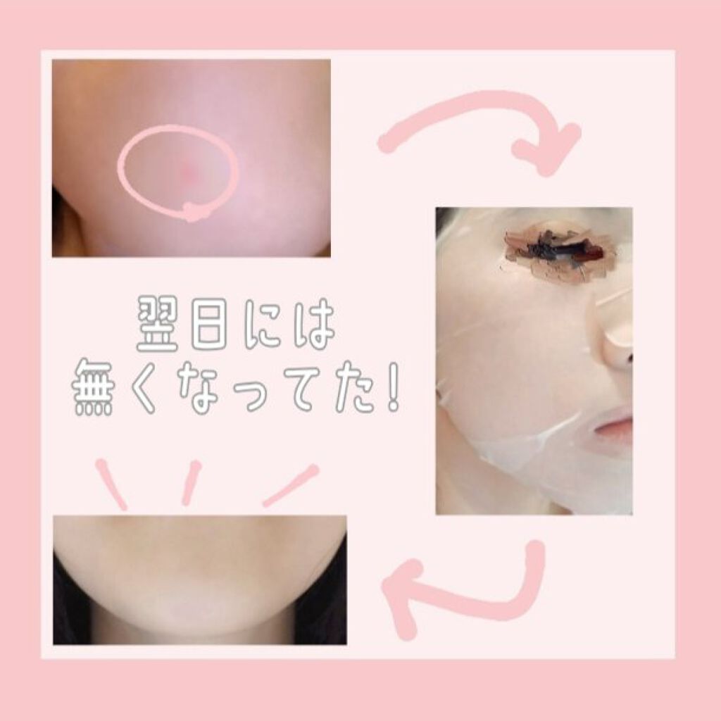 CICAデイリーケアマスク/FORWEALTHY/シートマスク・パックを使ったクチコミ(3枚目)