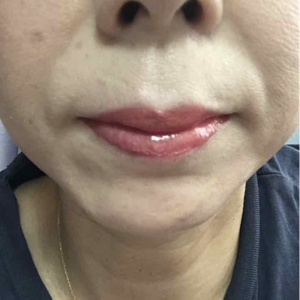 リップグロス N/NARS/リップグロスを使ったクチコミ(2枚目)