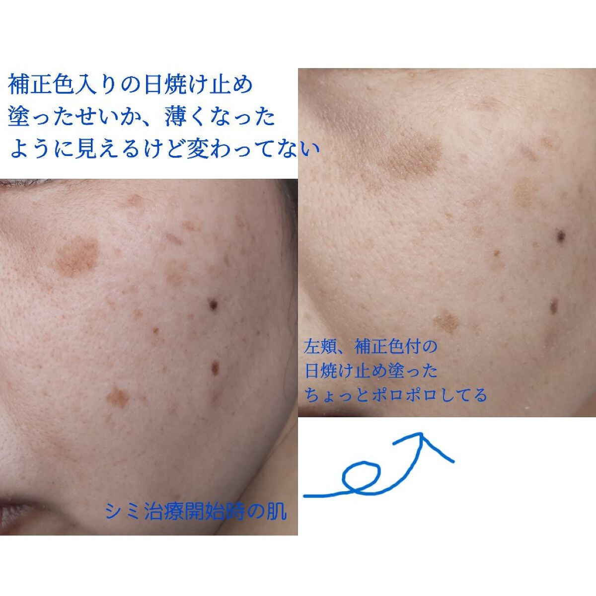 シナール錠200(医薬品)/シオノギ製薬/その他を使ったクチコミ(2枚目)