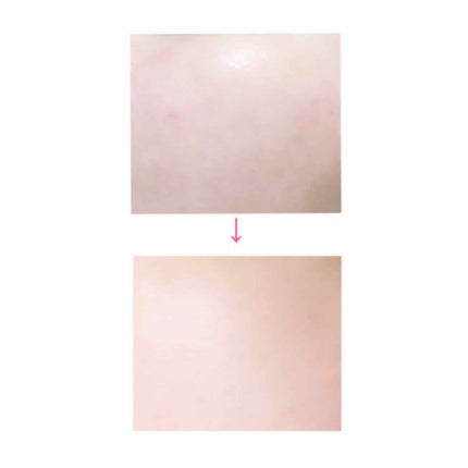 Lucrezia Serum(ルクレツィア セラム)/fearless/美容液を使ったクチコミ(3枚目)