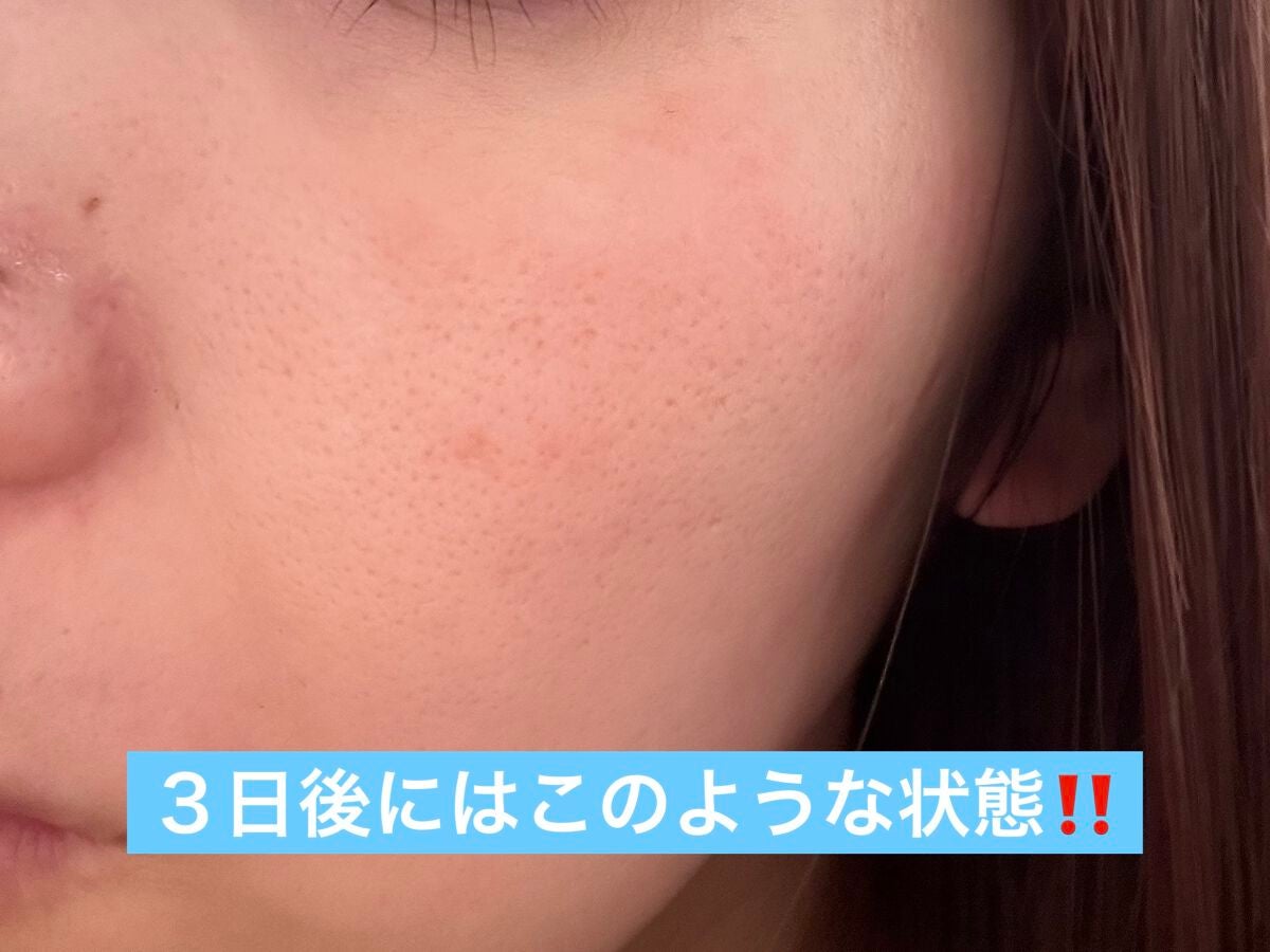 プリスクリードD(医薬品)/IHADA/その他を使ったクチコミ(3枚目)