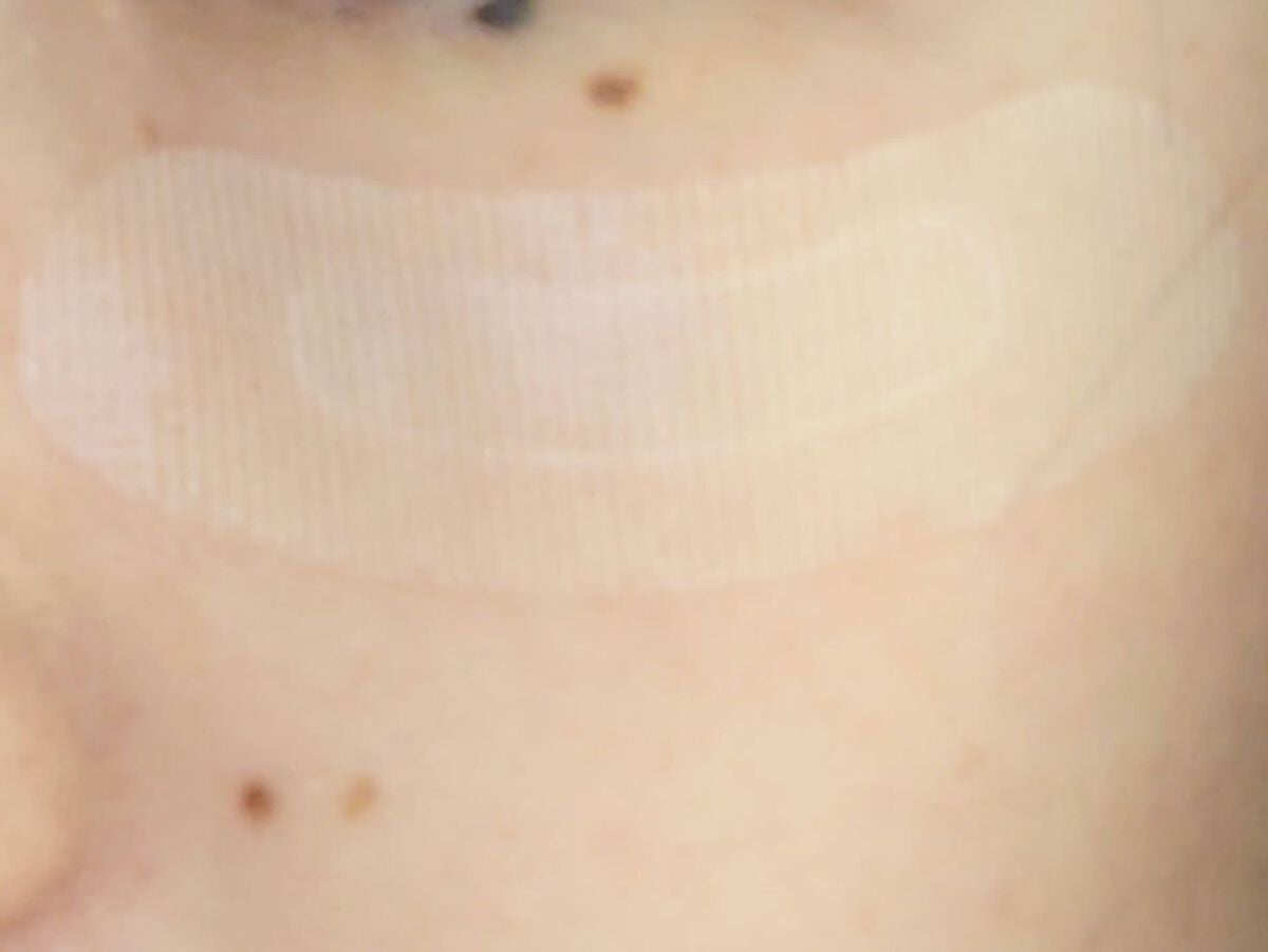 クリアターン ヒアロチューン マイクロパッチ 1500/クリアターン/シートマスク・パックを使ったクチコミ(3枚目)