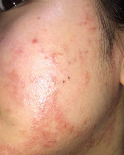 を使ったクチコミ(1枚目)