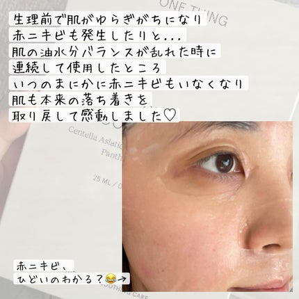 CICAスージングマスク/ONE THING/シートマスク・パックを使ったクチコミ(5枚目)