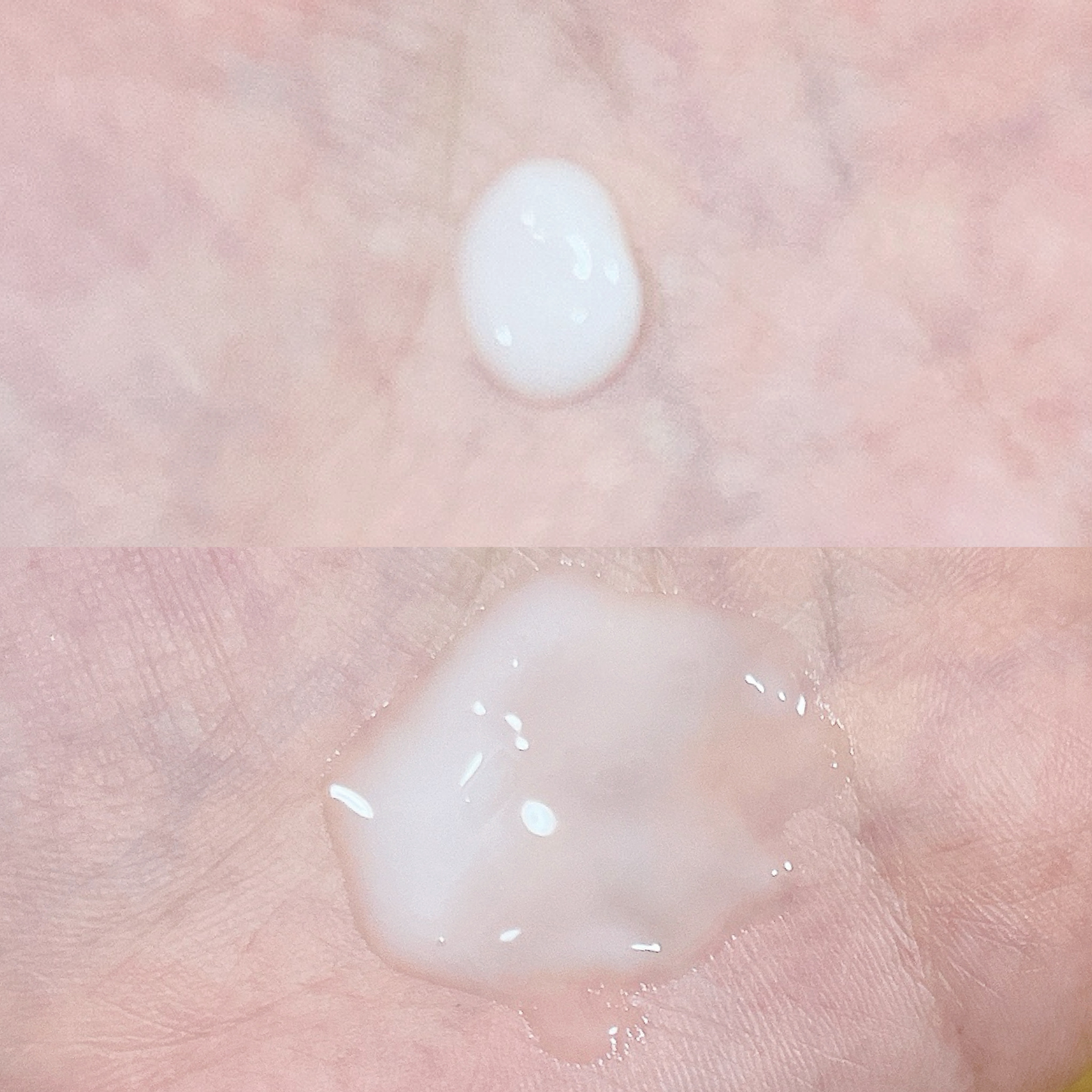 リードルショット100/VT/美容液を使ったクチコミ（2枚目）