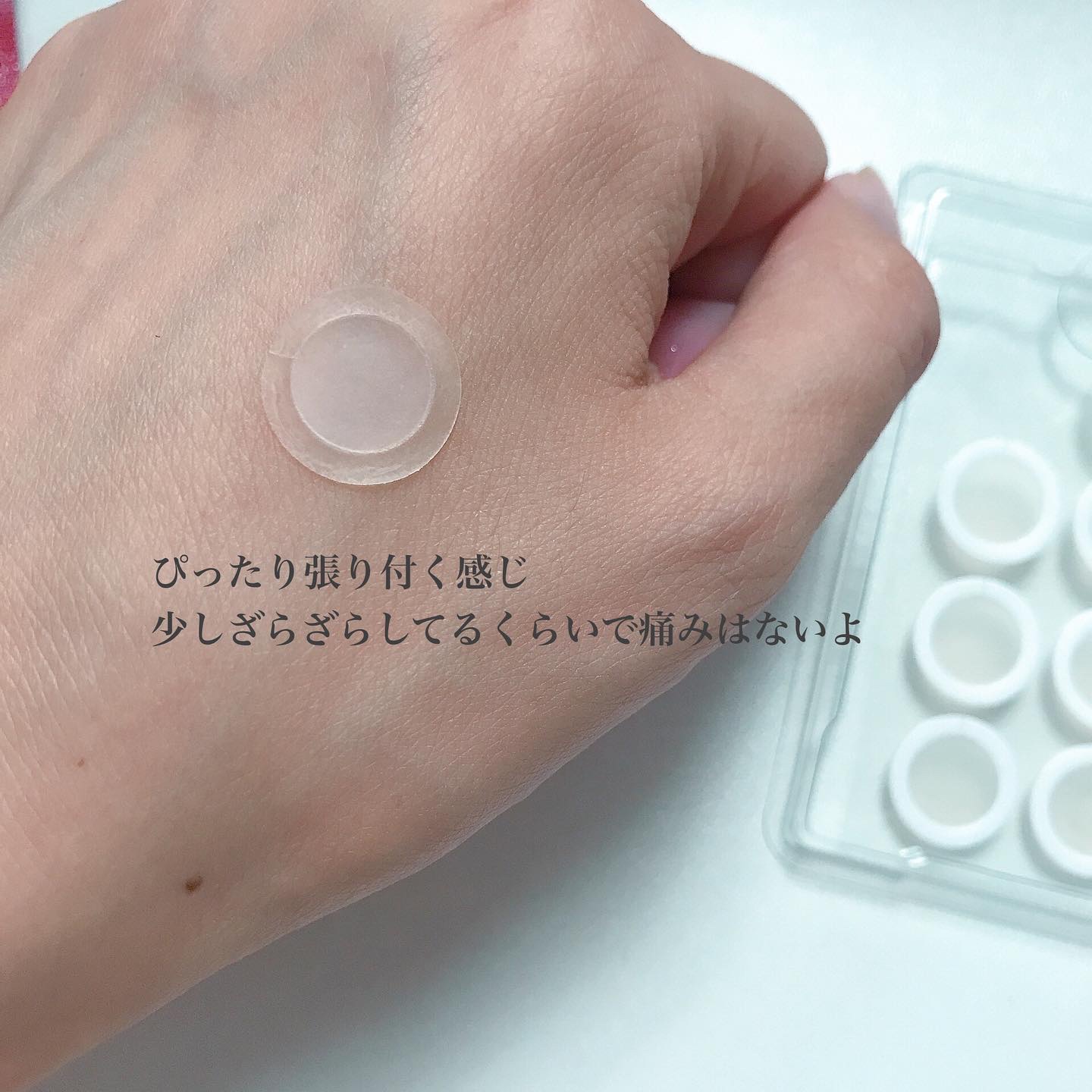 エーキュアショットスポットパッチ/obsero/にきびパッチを使ったクチコミ（3枚目）