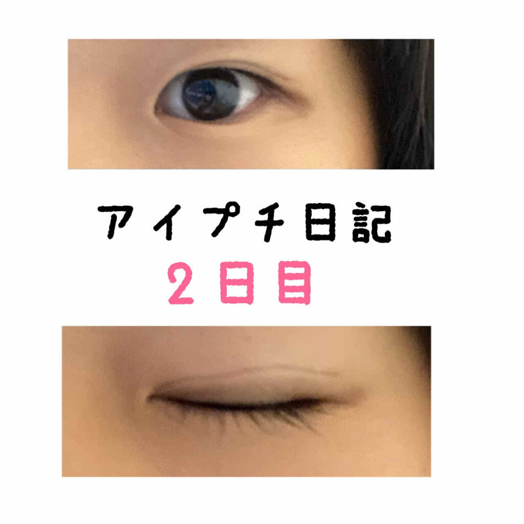 アイビューティー フィクサー WP/アストレア ヴィルゴ/二重まぶた用アイテムを使ったクチコミ（1枚目）