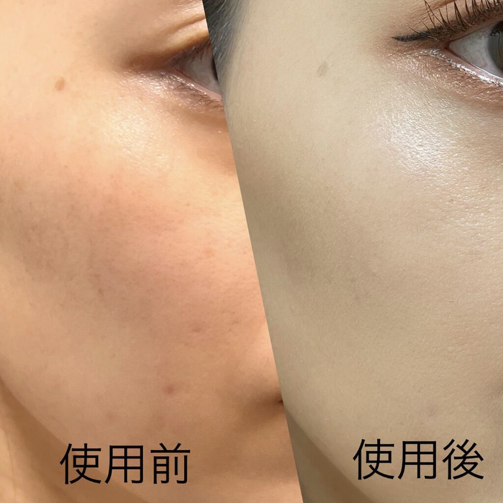 リキッド ファンデーション 20：オークル/iniks/リキッドファンデーションを使ったクチコミ（2枚目）