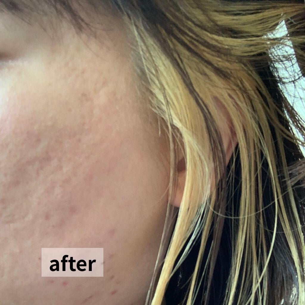 ベースアップブリーチ/ビューティーン/ブリーチ剤を使ったクチコミ(6枚目)