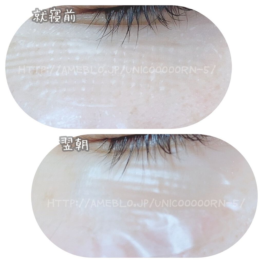 ヒアロビューティーマイクロパッチ/太陽のアロエ社/シートマスク・パックを使ったクチコミ(6枚目)