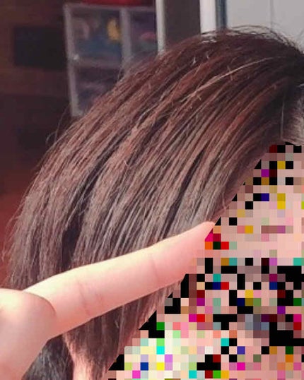 オキシドール(医薬品)/日本薬局方/その他を使ったクチコミ(4枚目)