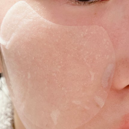 センテラ クイックカーミングパッド/SKIN1004/トナーパッドを使ったクチコミ(6枚目)