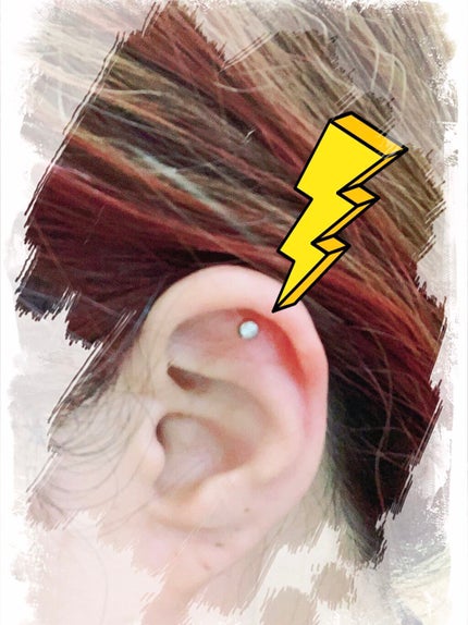 オキシドール(医薬品)/日本薬局方/その他を使ったクチコミ(3枚目)