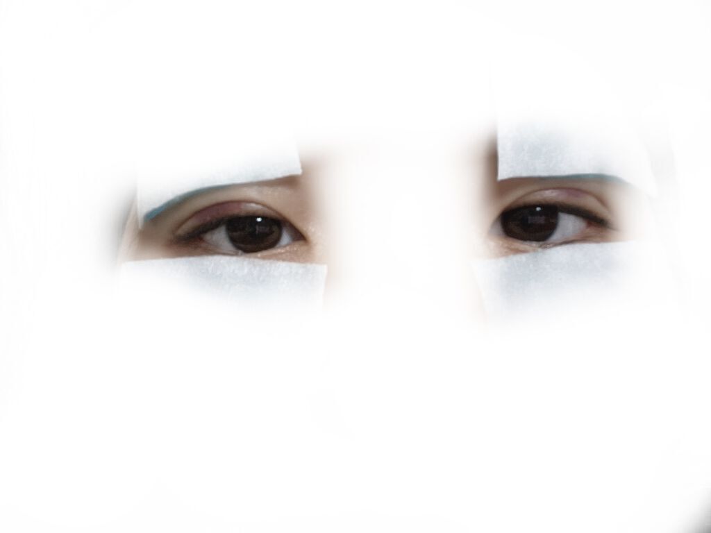 二重整形/その他を使ったクチコミ（2枚目）