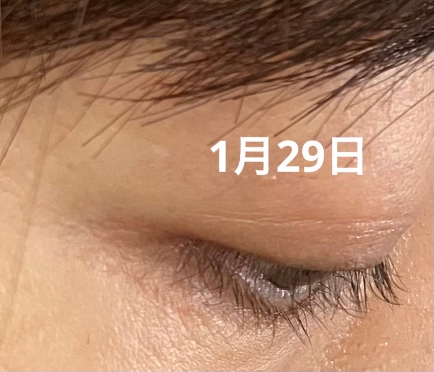 ラッシュアディクト アイラッシュコンディショニングセラム/soaddicted/まつげ美容液を使ったクチコミ(5枚目)