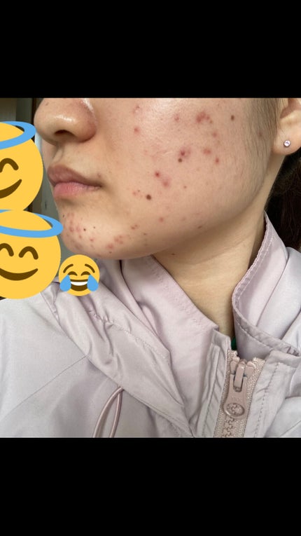 を使ったクチコミ(3枚目)