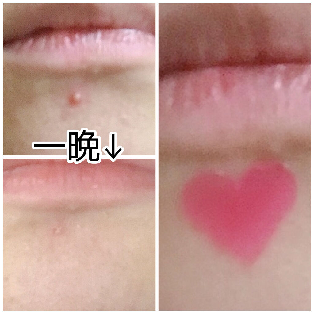 LOVE ME SKIN PATCH /コジット/シートマスク・パックを使ったクチコミ（2枚目）