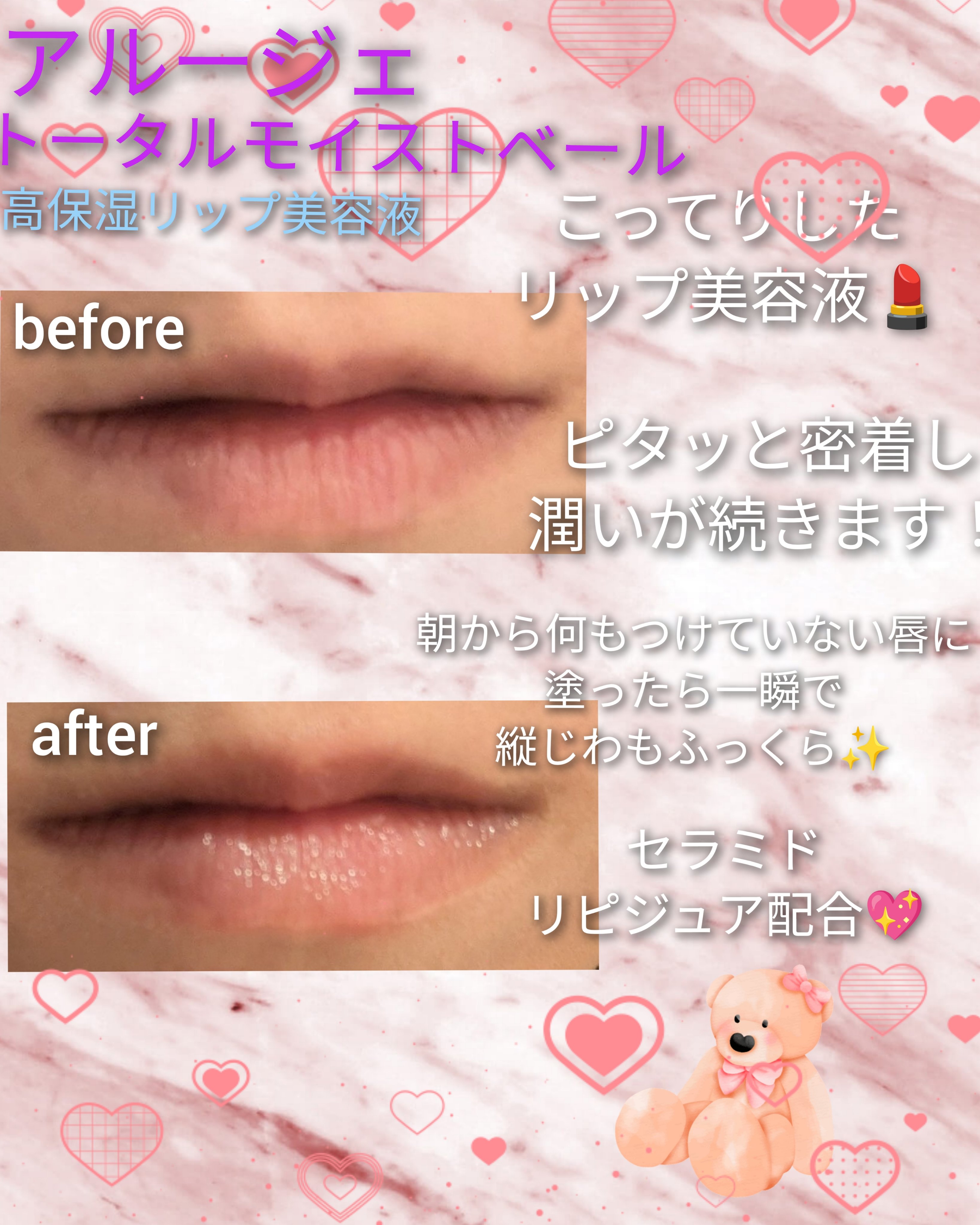 トータルモイストベール リップエッセンス/アルージェ/リップ美容液を使ったクチコミ（1枚目）