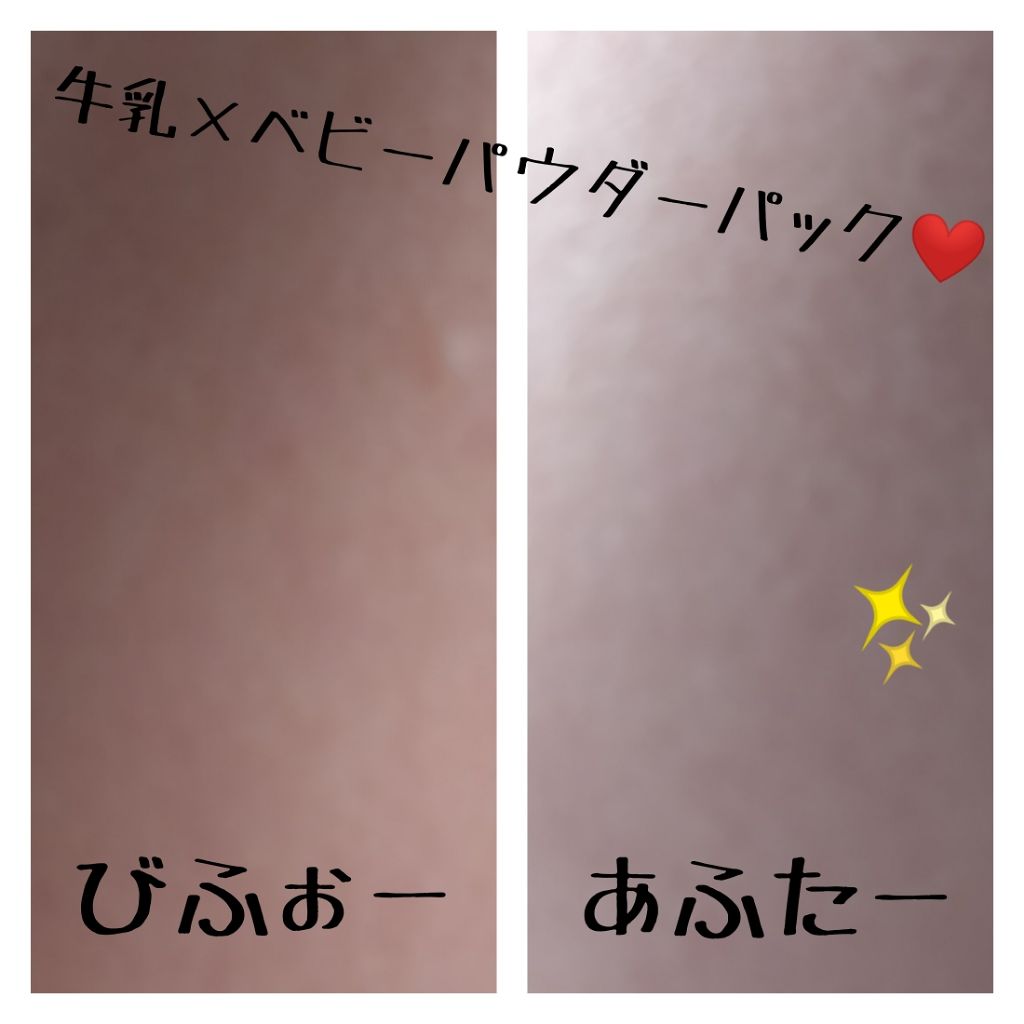 薬用ベビーパウダー ピジョンを使った口コミ 美白検証投稿関係 効果抜群美白パッ By りんご 敏感肌 10代前半 Lips