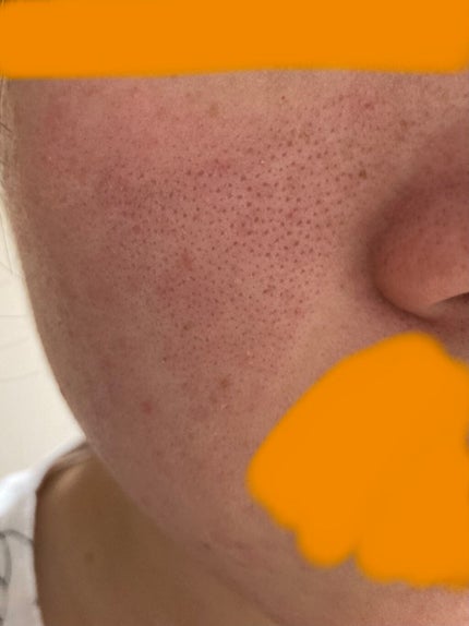 を使ったクチコミ(2枚目)