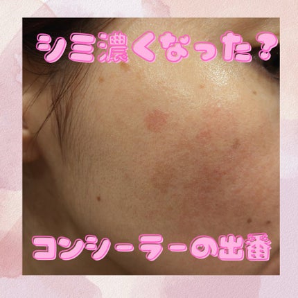 マスクフィットオールカバーデュアルコンシーラー/TIRTIR(ティルティル)/コンシーラーを使ったクチコミ(1枚目)