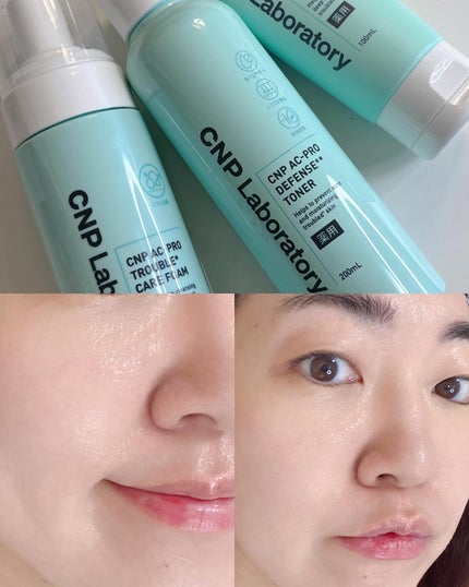 CNP AC 洗顔フォーム/CNP Laboratory/泡洗顔を使ったクチコミ(7枚目)