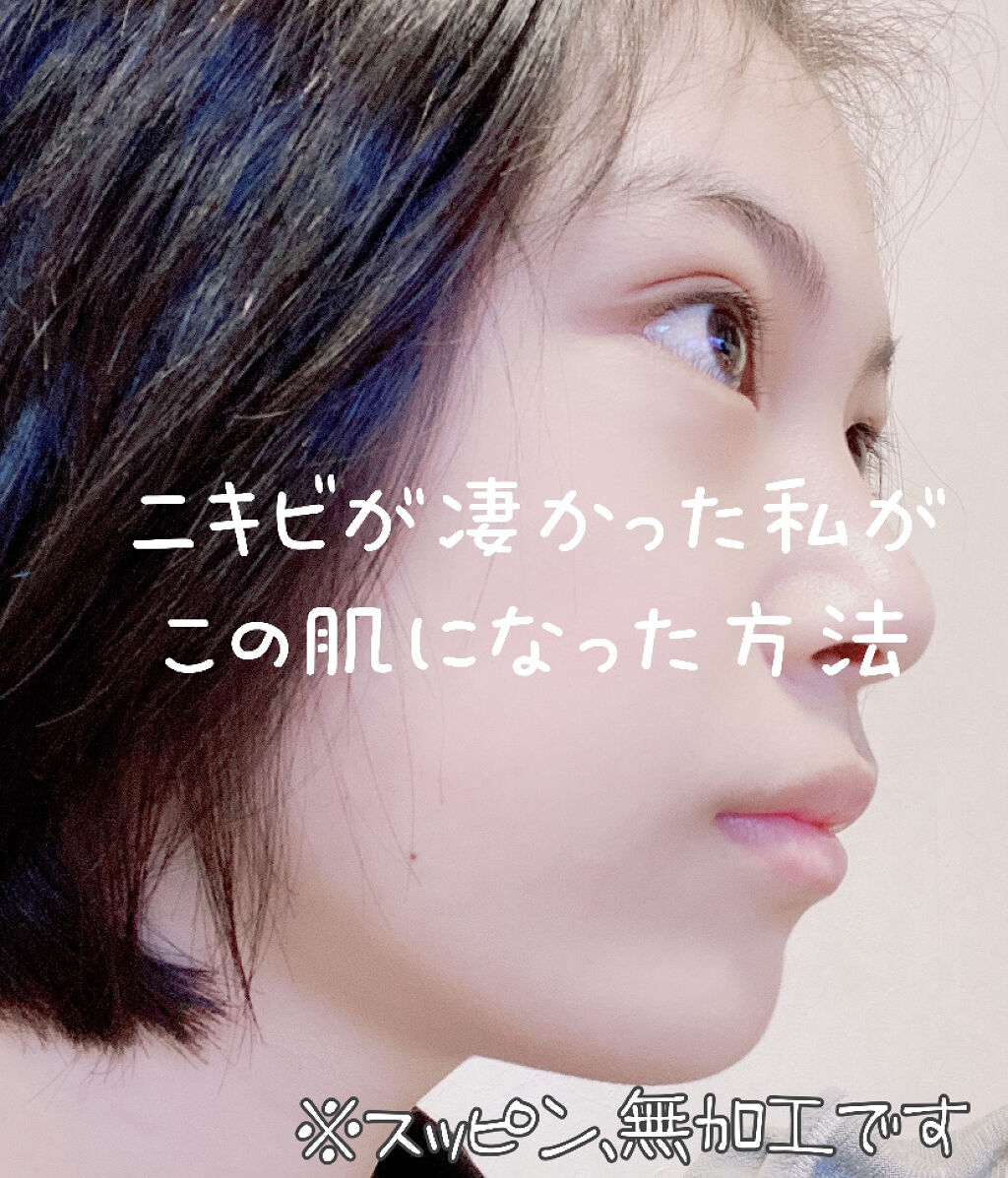 スキンケア洗顔料 薬用アクネケア/ビオレ/洗顔フォームを使ったクチコミ（1枚目）