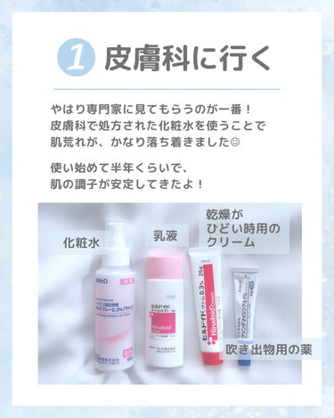 やなぎ もえな on LIPS 「𓍯ニキビ肌改善のためにやった5つのこと⁡⁡✔︎皮膚科に行く使い..」（2枚目）