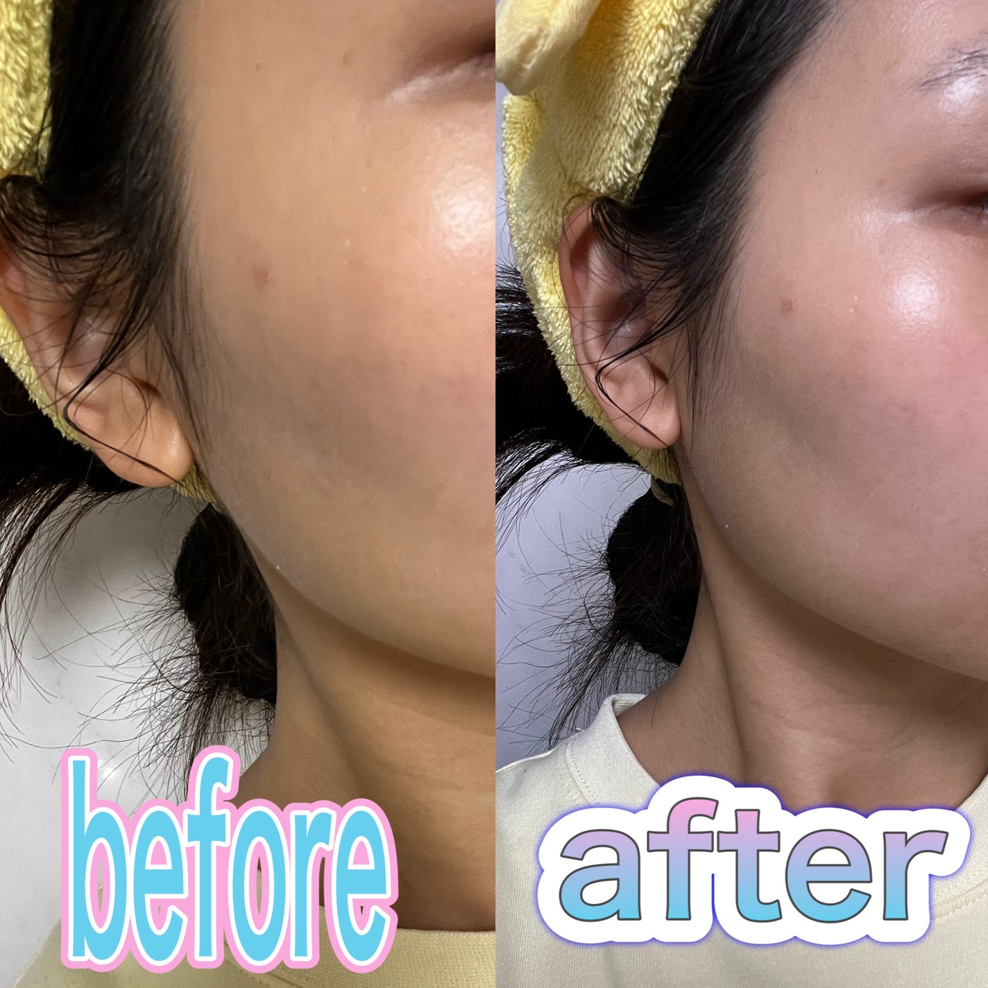 贅沢プラセンタのもっちり白肌美乳液/ホワイトラベル/乳液を使ったクチコミ(4枚目)