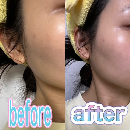 贅沢プラセンタのもっちり白肌美乳液/ホワイトラベル/乳液を使ったクチコミ(4枚目)