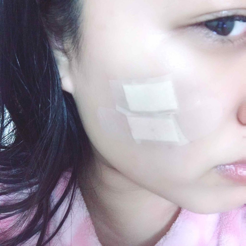 テラ・コートリル 軟膏(医薬品)/ジョンソン・エンド・ジョンソン/その他を使ったクチコミ(2枚目)