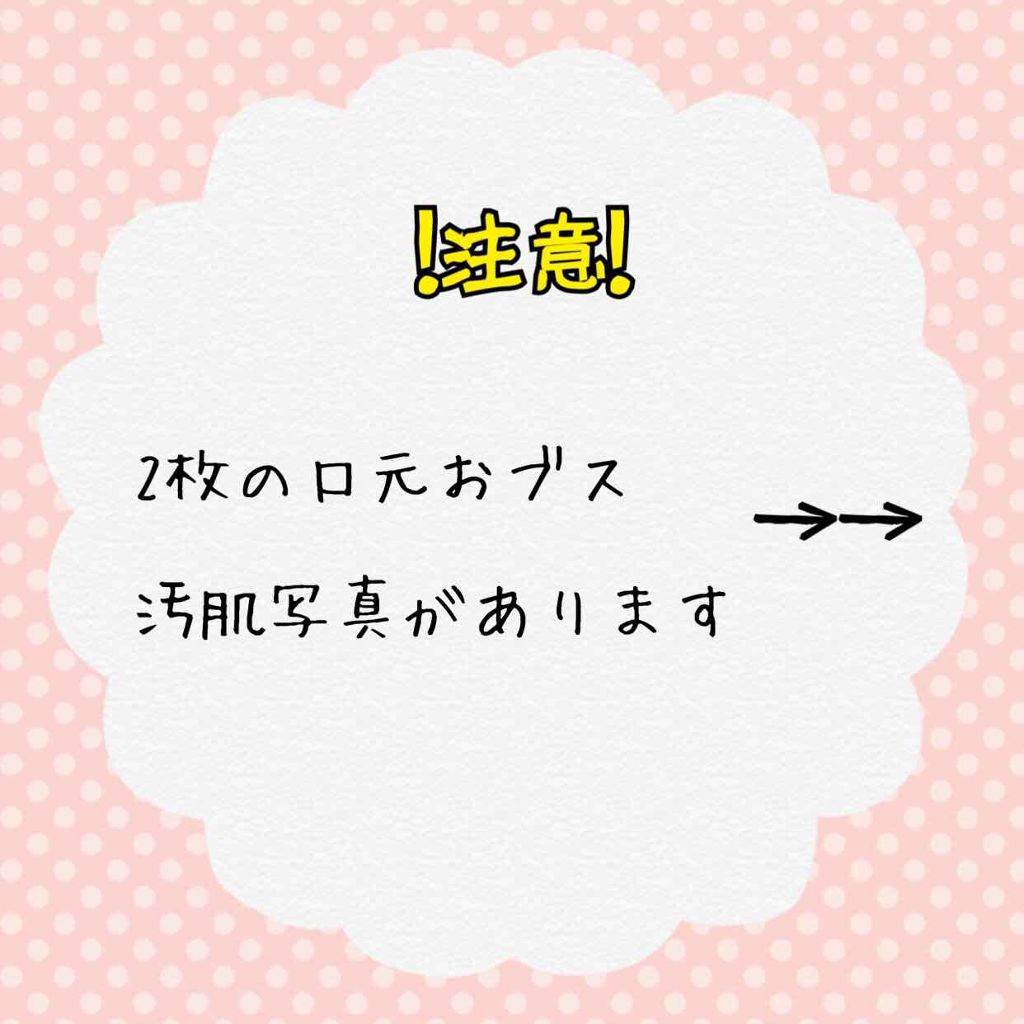 薬用パウダー化粧水/メンソレータム アクネス/化粧水を使ったクチコミ（2枚目）