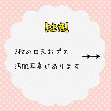 薬用クリーム洗顔/メンソレータム アクネス/洗顔フォームを使ったクチコミ（2枚目）