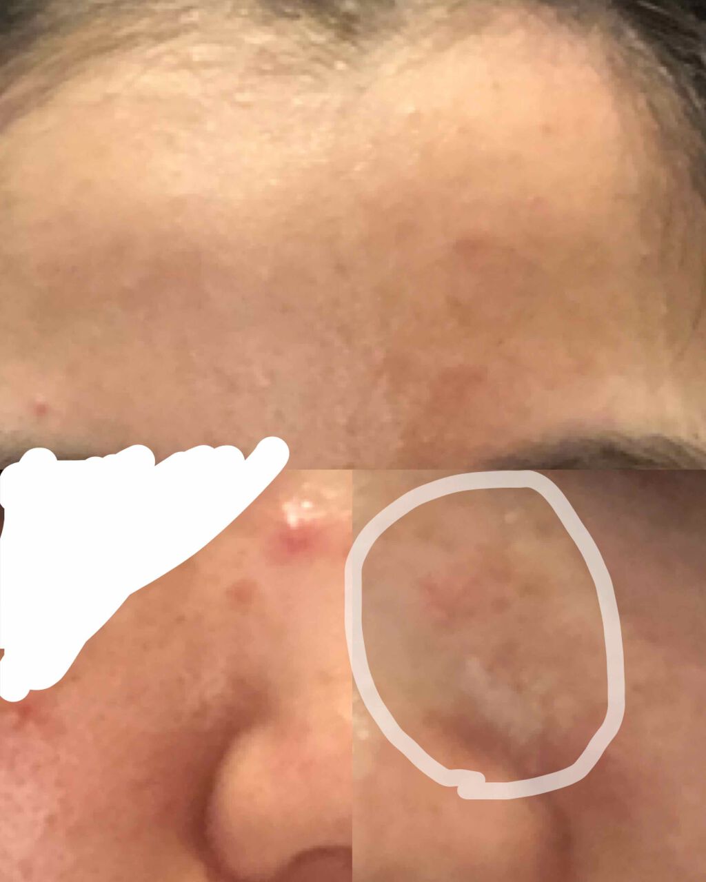 明色美顔水 薬用化粧水/美顔/化粧水を使ったクチコミ（2枚目）