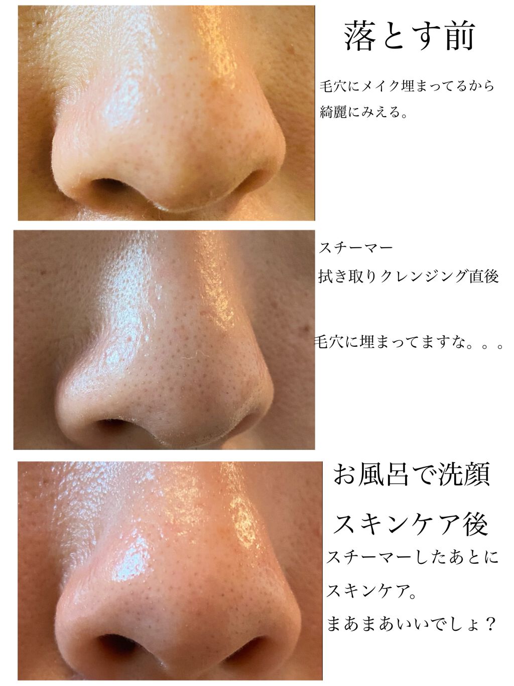 ブライトクリーン/YA-MAN TOKYO JAPAN/美顔器・マッサージを使ったクチコミ(8枚目)