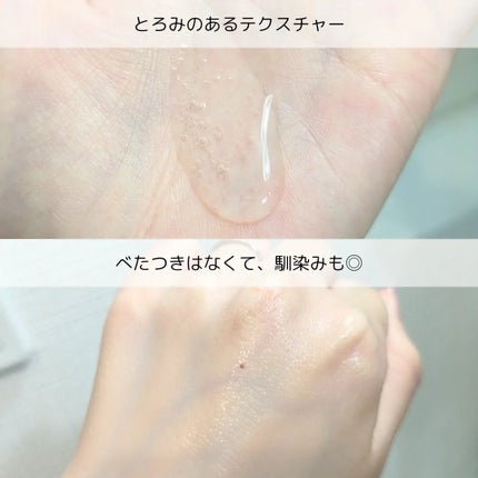 薬用マイクロバブルローション/Macchia Label/化粧水を使ったクチコミ(4枚目)