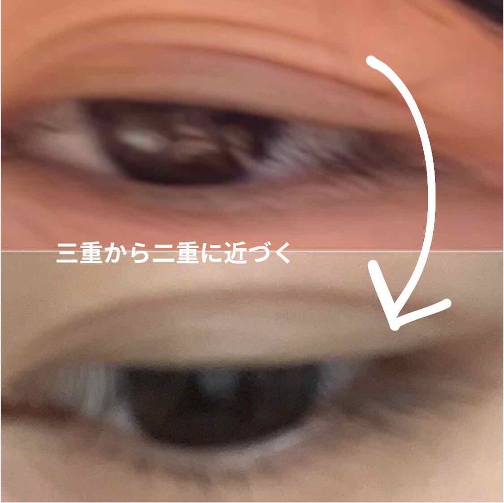 ナイトアイボーテ｜StreeTrendの口コミ - 三重から二重に近づく