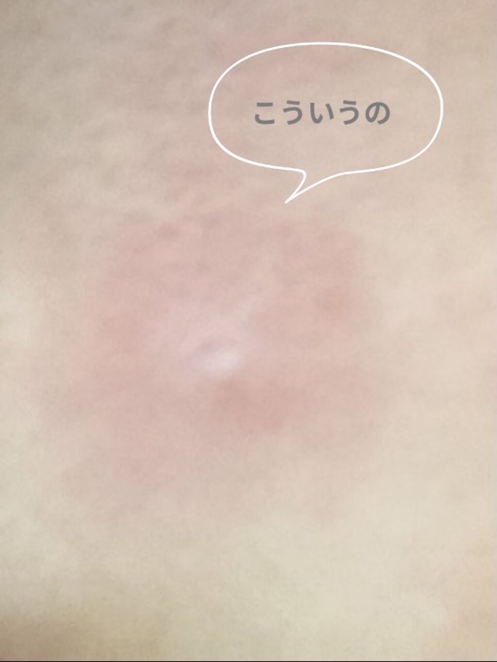 CICA デイリースージングマスク/VT/シートマスク・パックを使ったクチコミ（2枚目）