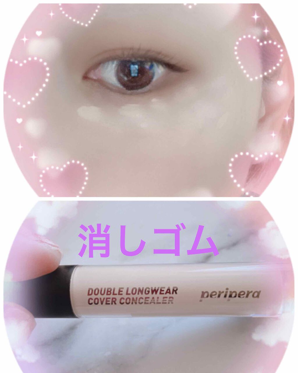 消しゴムパッド/その他スキンケアを使ったクチコミ（1枚目）