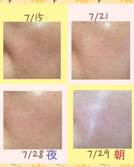 ビタペアC ビタレチ美容液/ネイチャーリパブリック/美容液を使ったクチコミ(4枚目)