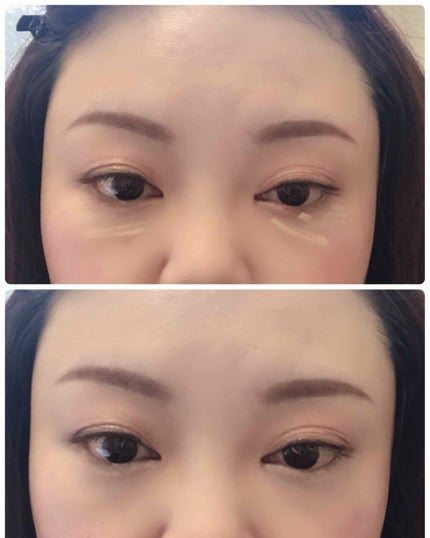 アイグロウ ジェム/DECORTÉ/ジェル・クリームアイシャドウを使ったクチコミ(2枚目)