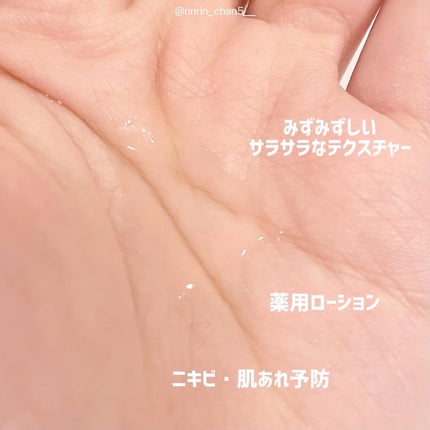 オードムーゲ 薬用ローション(ふきとり化粧水)/オードムーゲ/拭き取り化粧水を使ったクチコミ(2枚目)