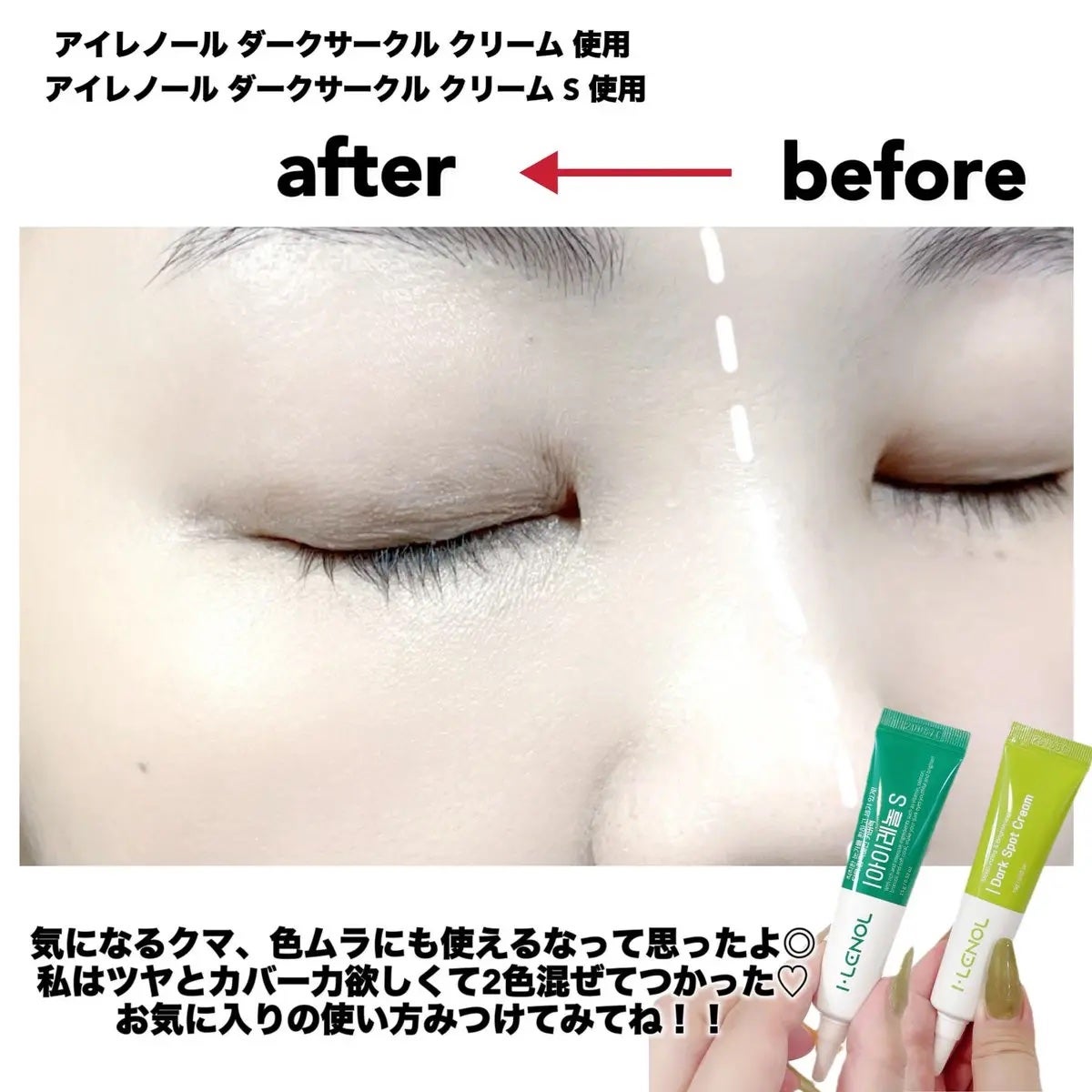 アイレノール クマクリーム/IRENOL/アイケア・アイクリームを使ったクチコミ(4枚目)