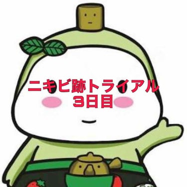 寝起きは皮脂脂があまり出てなく、さらさらでした

今日は夕方からバイトって事ぐらいしか用事ないのでギリギリまでメイクしないで少しでも肌を休ませようと思います

#bglen #ニキビ跡ケア トライアルセ