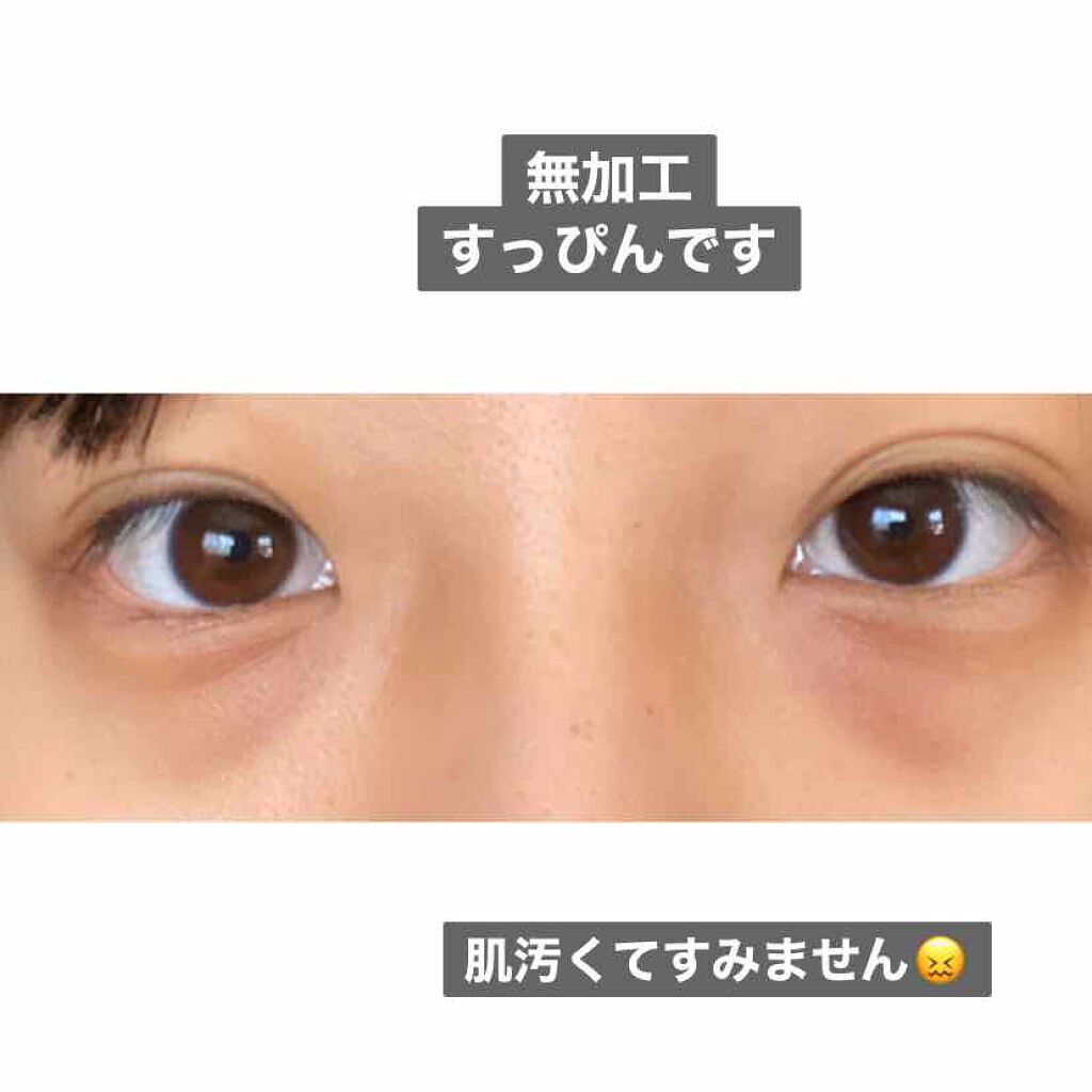 プラセホワイター 薬用美白アイクリーム 明色の効果に関する口コミ 3枚目肌汚くてすみません 私は昔から By ゎ 混合肌 10代後半 Lips