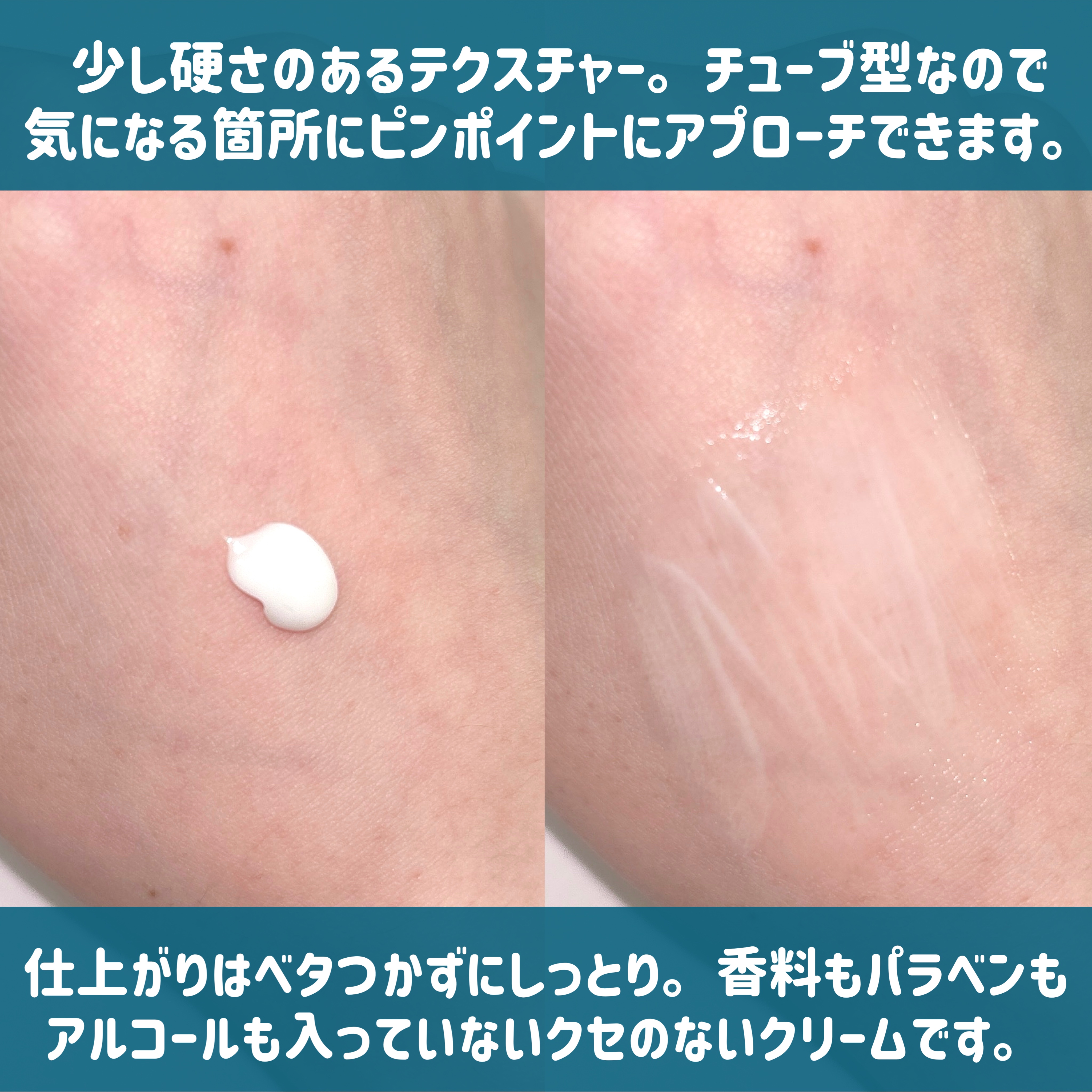 AZLAIN　クリーム　AZコンセントトレートクリーム/AZELAIN/フェイスクリームを使ったクチコミ（3枚目）