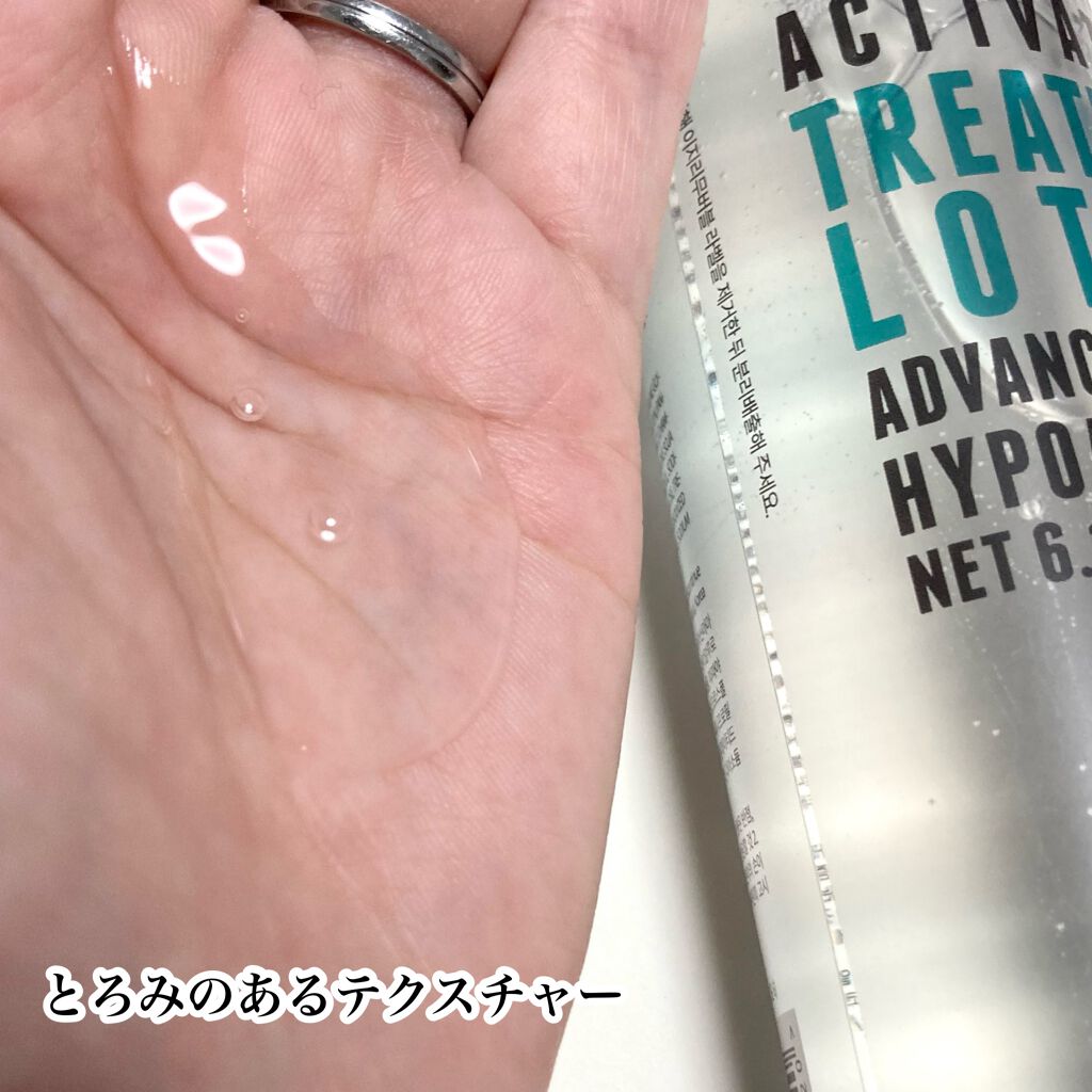 エッセンシャル トリートメントローション/ロベクチン/化粧水を使ったクチコミ(4枚目)